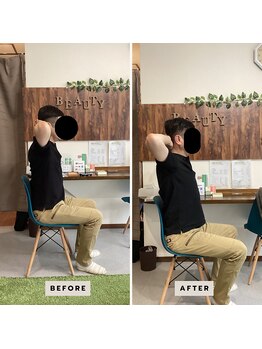 リポスト(RE:POST)/施術効果