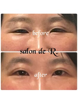 サロン ド アール(salon de R.)/【小顔骨氣・30代・お目元効果】