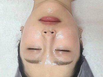 チュチュ(TUTU)の写真/【ホウレイ線・たるみに本気のケア】本格エイジングケアで肌本来の力を引き出し、ふっくらツヤ肌に。