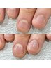 人気No.1【少しだけ長さだしたい！自然な深爪矯正】丁寧ケア付☆１～2mmまで