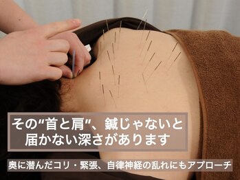 スプリング鍼灸院(Spring鍼灸院)/全身鍼施術