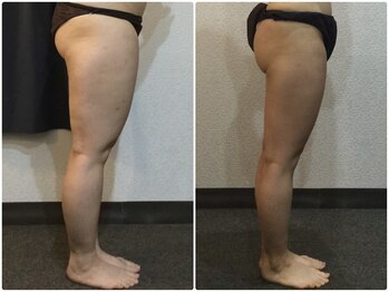 ウェリナ平和堂長久手院/小顔矯正/骨盤矯正/痩身/整体