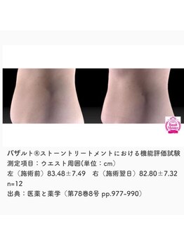 フルール エンビロン(フルール ENVIRON)/一回の施術でお腹周りもスッキリ