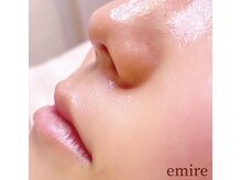 エミレ(emire)