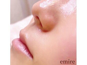エミレ(emire)の写真/【フェイシャルワックス脱毛】毛穴レスなうるツヤ肌へ。近距離でも自信♪触れたくなる透明感を実感◎