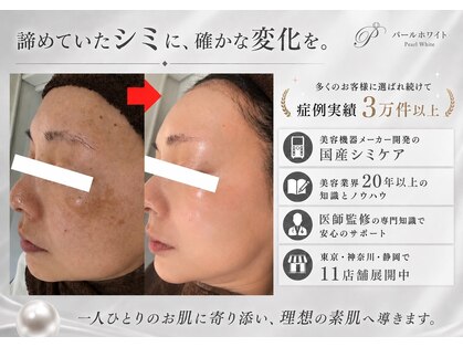 パールホワイトニングサロン 大和店の写真