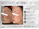 パールホワイトニングサロン 大和店の写真