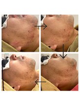 ミシェル(Michelle)/全身に使える高濃度導入美容液