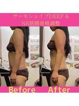 リラクゼーションサロン ラキ(laki)/サーモシェイプ&NR筋膜骨格調整