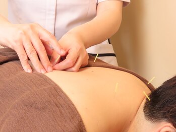 住吉鍼灸院アネックス/鍼灸施術