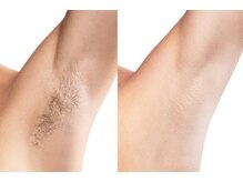 オベリオ 渋谷(OBERIO)の雰囲気（業界最強脱毛器！男性も女性もしっかりと抜ける脱毛を♪【脱毛】）