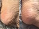 爪のいろはの写真/《専属フットケアサロン☆》硬くなった足裏の角質を丁寧にケアし、滑らかなかかとを手に入れましょう♪