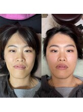 環/小顔矯正ビフォーアフター