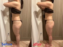 ルミナス 八尾店(Luminous)/痩身ビフォー・アフター