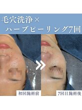 エミーニー(emiiny)/肌トーンもUP！！