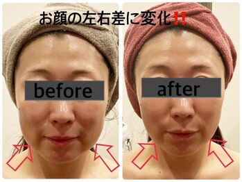 マリスレジーナ 新保店(MarisRegina)/コルギ