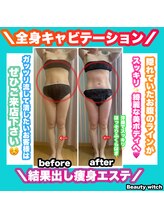 ビューティ ウィッチ(Beauty Witch)/