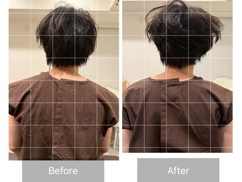 ナオル整体 恵比寿院(NAORU整体)/恵比寿/整体事例