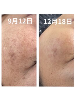 コンディションスキン(condition skin)/