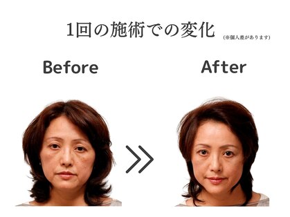 ケー(K)の写真