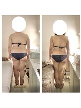 アクア エステティコ 亀有(ACQUA estetico)/上半身　3ヶ月変化　40代
