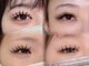 アルレ(ALRE)の写真/【圧倒的なモチの良さ◎】すぐ取れてしまう、デザインにいつも悩む・・・そんな方は《ALRE》にお任せ★