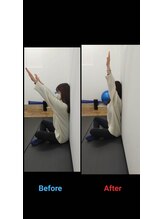 ぷらもーる梅屋敷整骨院/ビフォーアフター　#整体 #蒲田