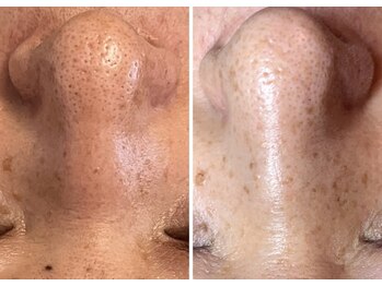 エヌエクラ(N.eclat.)/商品のみご購入のお客様