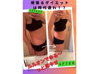 ヨサパーク セルヴィ(YOSA PARK セル美)の写真/【1回での劇的変化に感動の声続出！】ムダ肉を一気に撃退！結果重視◎あなたの本気痩せを徹底サポート！