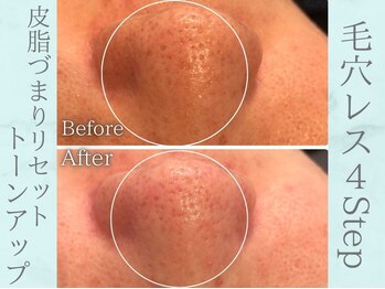 ネオファースト(NeoFirst)/トーンアップで艶感アップ♪