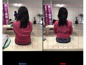 ストレチックス 近江八幡店/BeforeAfter