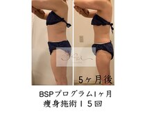アイ エステサロン(Ai)/【50代】贅肉を落としたい！