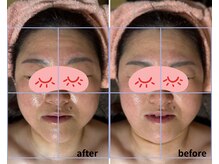 ソフィアアイズ 倉敷店(SOPHIAEYES)/ハイパーナイフ＆レモンボトル