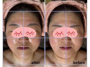 ソフィアアイズ 倉敷店(SOPHIAEYES)/ハイパーナイフ＆レモンボトル