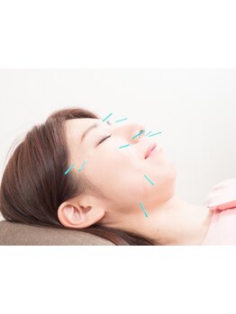 鍼灸施術を受けたい