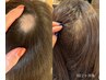 大人気！幹細胞lit【髪ハリコシ・抜け毛】にお悩みの方に