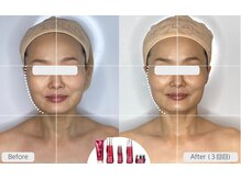 ドクタープラント 北心斎橋店(DR PLANT)の雰囲気(高山植物スキンケア×東洋医学を基にした美容術*本気の肌質改善)