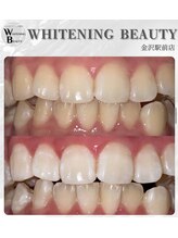 ホワイトニングビューティー 金沢駅前店(WHITENING BEAUTY)/コーヒーが好きな方でも◎