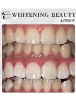 ホワイトニングビューティー 金沢駅前店(WHITENING BEAUTY)/コーヒーが好きな方でも◎