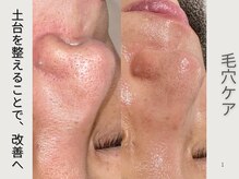 エン(en.)の雰囲気(毛穴はサロンケア × ホームケアで整える)