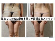 スリーピングビューティー(Sleeping Beauty)の雰囲気（夏までに痩せて、肩コリ浮腫みもスッキリへ！本気のインディバ！）