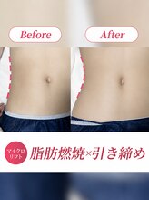 リフト 川崎(Lift)&nbsp;最新マシン 小顔矯正