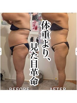 ベルフルール 浜松中野町店/セルライトゼロ痩身