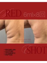 美温(mion)/美温のお写真が選ばれました