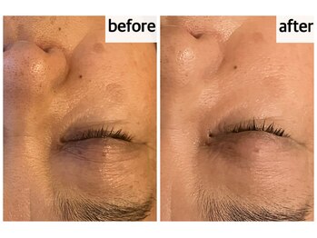 メナードフェイシャルサロン 岐阜茜部/しわたるみ/エイジングケア