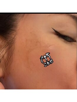 ジーニー(Genie)/これが脱皮！！！