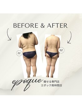 エステティックサロン エポック(epoque)/TMキューブ★スリムボディへ