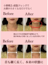 ピオニー(Peony)/首の太さ、長さも変わるんです