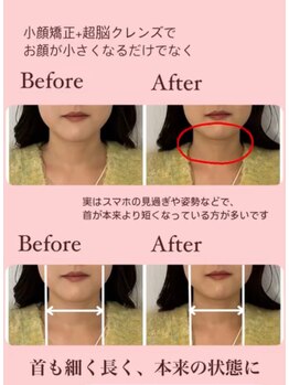 ピオニー(Peony)/首の太さ、長さも変わるんです