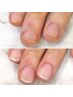 人気No.2【しっかり長さだし！自然な深爪矯正】丁寧ケア付☆3～5mmまで